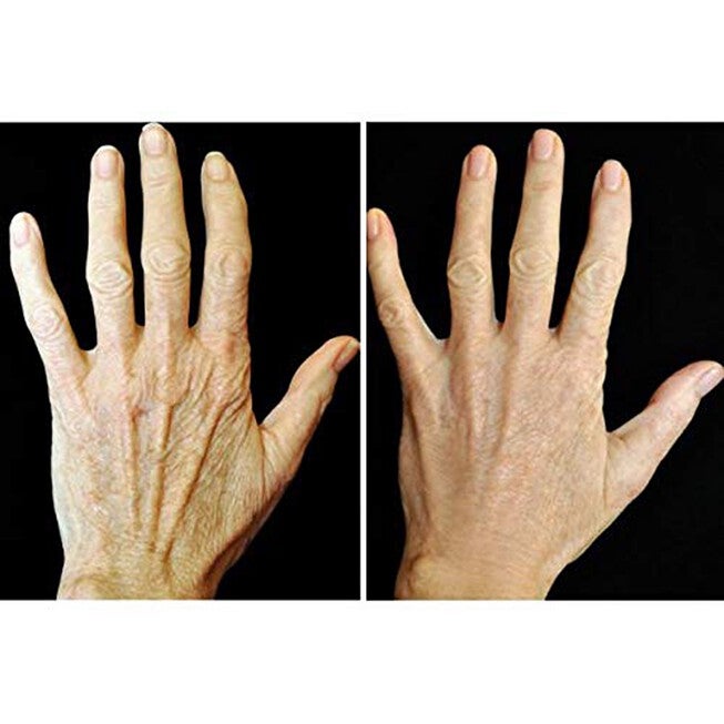 Crepe Gone Facial Souffle Anti Aging Skin Cream Beauty Tools, , alternate image number 5