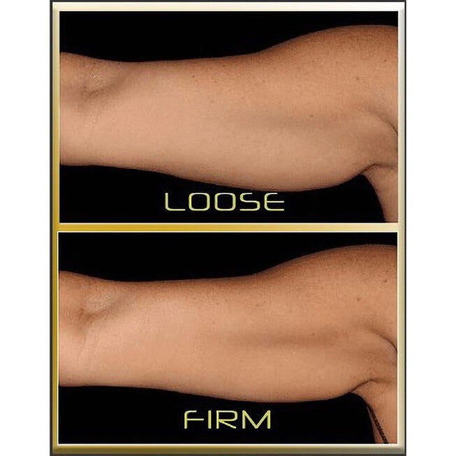 Thermoslim Arms Wellness, , on-hover image number null