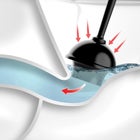 Plungeroo image number null